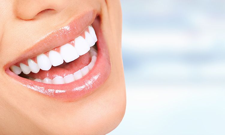 Quanto custa para fazer um Implante Dentário.