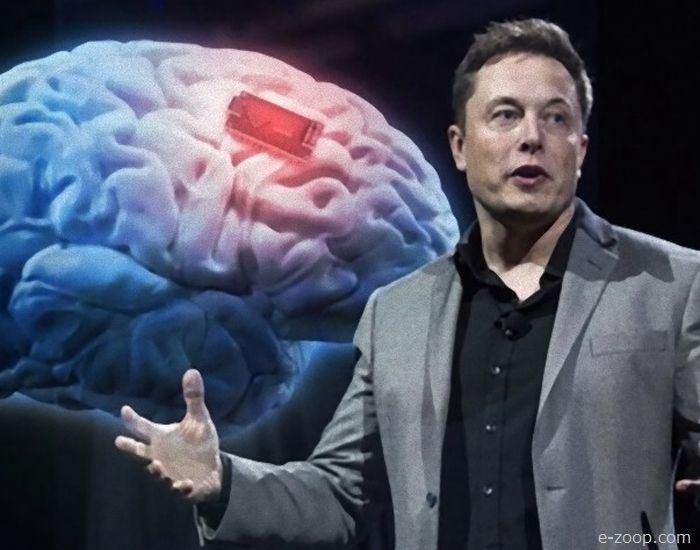 Segundo Elon Musk, Neuralink fará revelação impactante no final de agosto